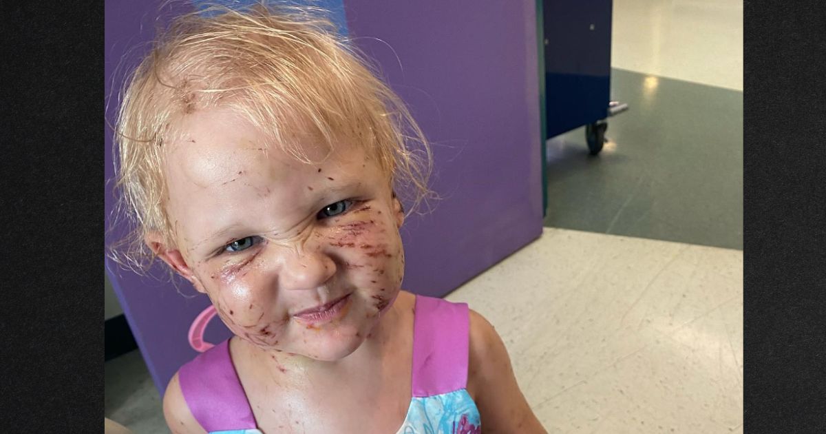 Felicity's mom says she is "doing great" after being attacked by four puppies, who bit the toddler's face and chewed off part of her ear.