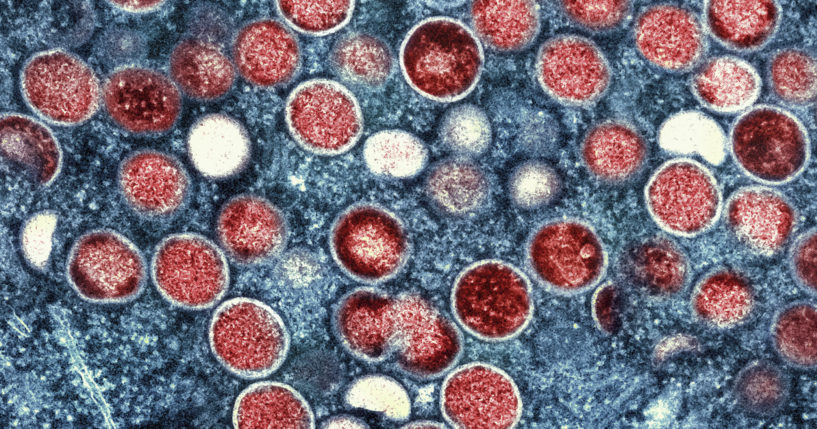 This image provided by the National Institute of Allergy and Infectious Diseases shows a colorized transmission election micrograph of monkeypox particles (red) found within an infected cell at an NIAID Integrated Research Facility in Fort Detrick, Maryland.