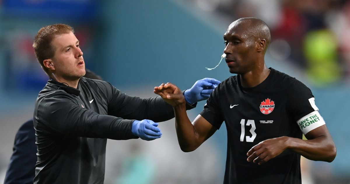 A medic, left, uses an unconventional tool to help Atiba Hutchinson, right, of Canada stop a nosebleed during the FIFA World Cup match against Croatia Sunday in Doha, Qatar.