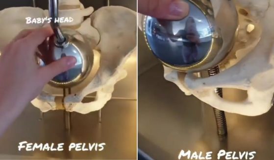 A Twitter video demonstrates the difference between a female pelvis, designed for a baby's head to fit through, and a male pelvis.