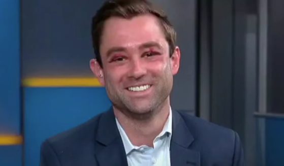 Fox News weatherman Adam Klotz appeared on "Fox and Friends" on Monday morning to discuss the attack he experienced on a New York City Subway.