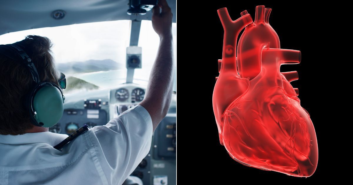 Dr. Thomas Levy, a cardiologist, has expressed concerns after the FAA changed a key medical requirement for pilots.