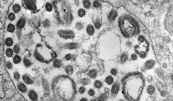 The above image is of a transmission electron micrograph (TEM) of the Marburg virus.