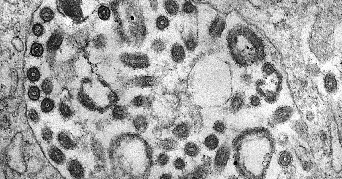 The above image is of a transmission electron micrograph (TEM) of the Marburg virus.