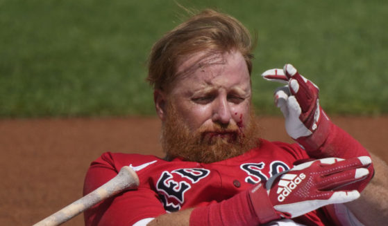Justin Turner reacts after being hit in the face on a pitch