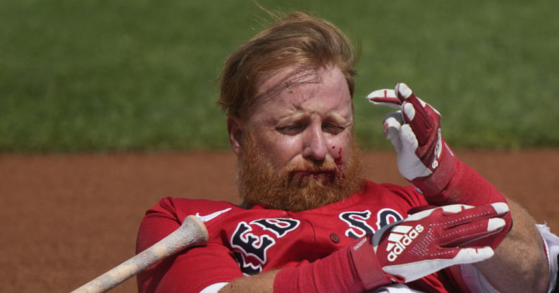 Justin Turner reacts after being hit in the face on a pitch