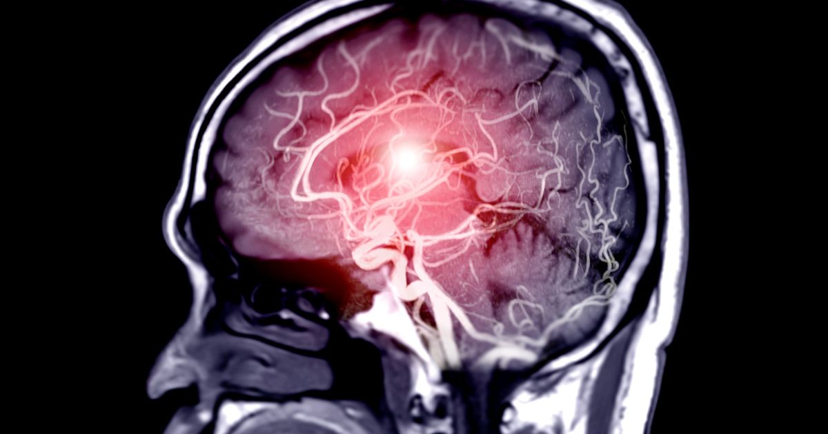 A brain scan is seen in this stock image.