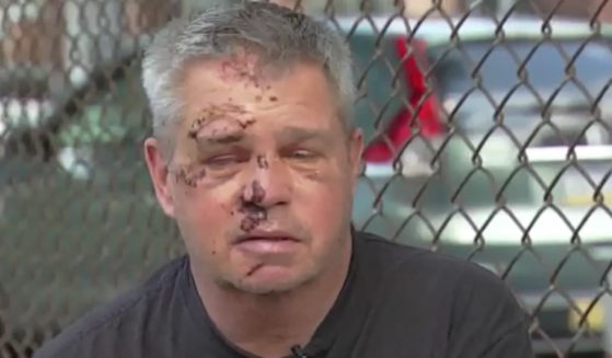 Navy veteran Scott Harris was brutally beaten while out for a walk in his Philadelphia neighborhood on Saturday.