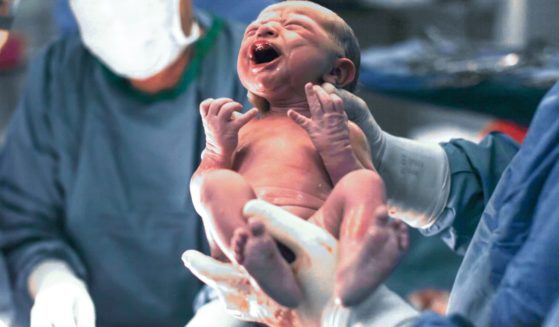This stock image depicts a newborn baby.