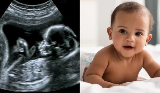 An ultrasound image of a baby in the wormb, left; a smiling baby, right.