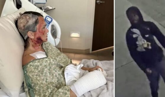 Ashley Wasielewski was attacked with a corrosive substance in Savannah, Georgia, on Dec. 10, 2025.