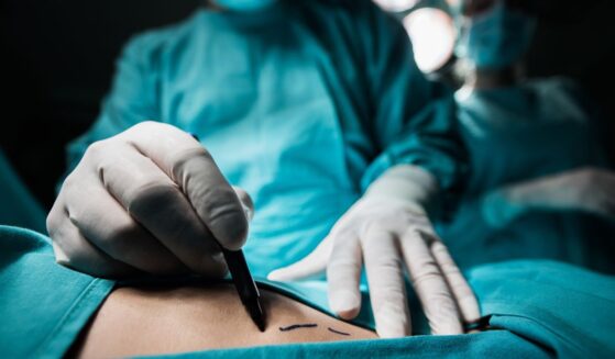 A close-up of a plastic surgeon marking the human skin for surgery.
