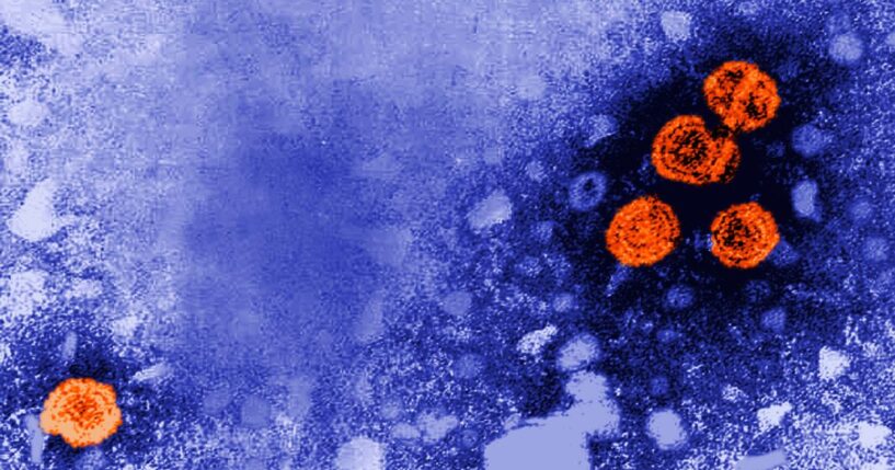 A 1981 microscopic photo of Hepatitis B is pictured.