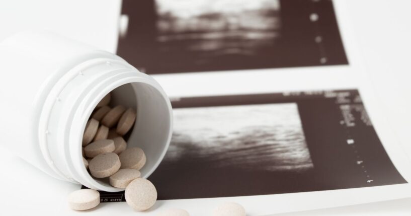 Abortion pills are depicted in front of an ultrasound.