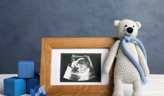 A composition with a child's ultrasound photo and toys.