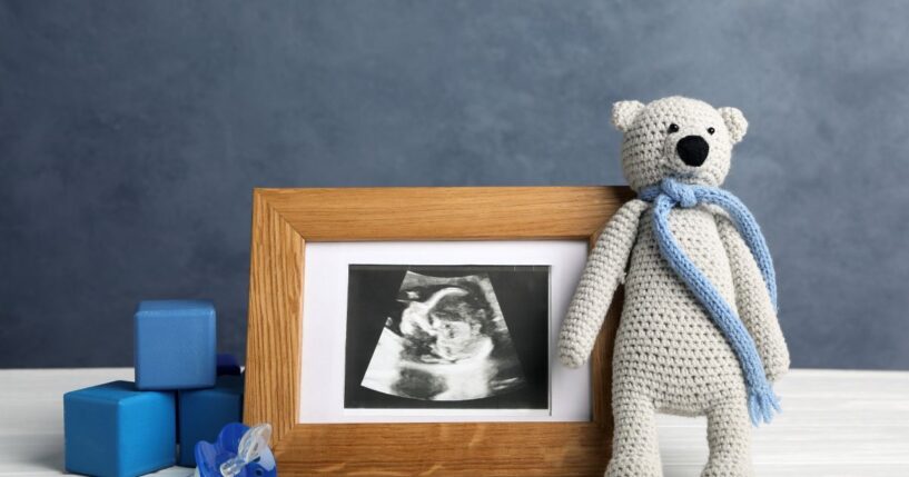 A composition with a child's ultrasound photo and toys.